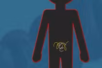 Video: Bỏ túi những lưu ý khi tẩy giun cho trẻ