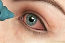 Cách sơ cứu khi trẻ bị vật nhọn đâm vào mắt