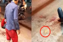 Clip: Thanh niên bị giang hồ chém đứt lìa tay ở Sài Gòn