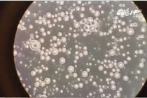 Video sữa mẹ dưới kính hiển vi hút người xem trên mạng xã hội