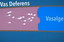 Video: Sắp có thuốc giúp đàn ông tránh thai suốt... 2 năm