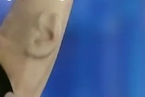 Người đàn ông có tai thứ 3 kỳ lạ trên cánh tay