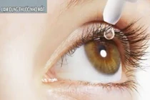 8 thói quen gây hại cho mắt bạn cần bỏ ngay