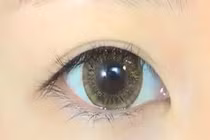 Các nguy cơ khi sử dụng kính áp tròng bạn chưa biết