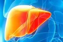 Thực phẩm cho người bị gan nhiễm mỡ nên bổ sung