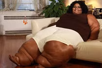 Người phụ nữ có đôi chân quái vật muốn làm cô dâu