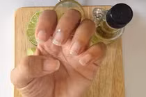 Video: Mẹo trị móng tay bị vàng và dễ gãy