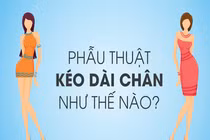 Video: Phẫu thuật kéo dài chân như thế nào?