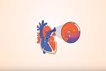 Video: Bệnh tim bẩm sinh có thể tự hồi phục