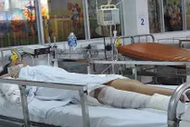Mẹ tưới xăng thiêu sống con gái: Bé đã qua cơn nguy kịch