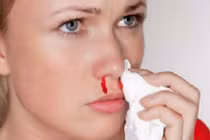 Những căn bệnh nguy hiểm tiềm ẩn đằng sau chứng chảy máu cam