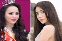 Lộ bằng chứng Hoa hậu Kỳ Duyên nói dối chuyện cằm nhọn