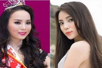 Lộ bằng chứng Hoa hậu Kỳ Duyên nói dối chuyện cằm nhọn