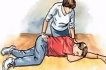 Cách xử lí tai biến mạch máu não đúng chuẩn