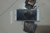 Bỏng đùi vì điện thoại Xiaomi phát nổ tại Việt Nam