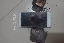 Bỏng đùi vì điện thoại Xiaomi phát nổ tại Việt Nam