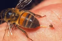 Cách xử lý khi bị ong đốt nhất định phải nhớ