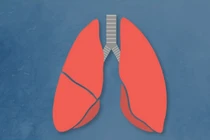 Video: 10 thực phẩm ngăn ngừa nguy cơ ung thư phổi