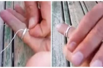 Mẹo hay giúp bạn tháo nhẫn mắc kẹt trong ngón tay