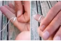 Mẹo hay giúp bạn tháo nhẫn mắc kẹt trong ngón tay