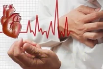 Những điều không nên làm sau cơn nhồi máu cơ tim