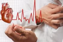 Những điều không nên làm sau cơn nhồi máu cơ tim