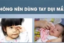 Phòng ngừa đau mắt đỏ đúng cách và hiệu quả thế nào?