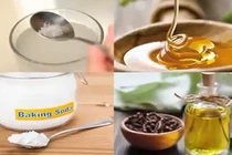 Mẹo chữa bệnh chảy máu chân răng cực hiệu quả