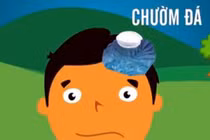 Video: Cách xử lý đúng nhất khi trẻ bị đập đầu xuống đất