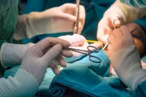 Những biến chứng người phẫu thuật thẩm mỹ có thể gặp phải