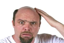 Tự chế "thần dược" trị hói đầu, rụng tóc cho phái mạnh