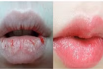 Video: Bôi thứ này để qua đêm, đôi môi nứt nẻ trở nên hồng hào 
