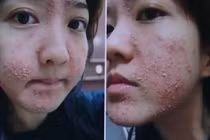 Hiểm họa khôn lường từ son handmade giá rẻ, mỹ phẩm tự chế