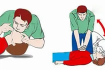 Nguyên nhân và cách phòng chống đuối nước bạn nên biết