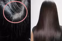 Cách khắc phục tình trạng tóc bạc sớm bằng quả khế