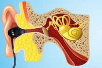 Cách hạn chế tác hại khi dùng tai nghe