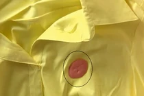 Cách tẩy kẹo cao su dính trên quần áo