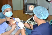 Viên bi nhựa nằm sâu trong hốc mũi của bé trai 4 tuổi