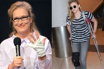 Những lần bị thương của sao Hollywood khiến fan xót xa