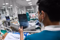 Viêm não mô cầu nguy hiểm thế nào?