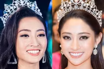 Nghi vấn Lương Thùy Linh làm răng sau đăng quang 