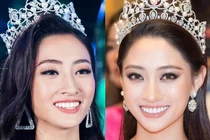 Nghi vấn Lương Thùy Linh làm răng sau đăng quang 