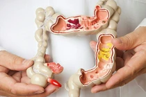 Cứu sống cụ bà 100 tuổi chảy máu trực tràng ồ ạt​