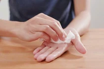 Ra mồ hôi tay kéo dài coi chừng dấu hiệu bệnh lý