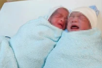 Cứu cặp song sinh mắc hội chứng truyền máu song thai