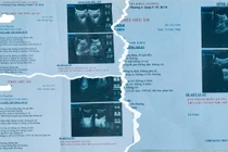 Bộ Y tế vào cuộc vụ Phòng khám An Đông “vẽ bệnh moi tiền”