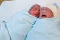 Cứu cặp song sinh mắc hội chứng truyền máu song thai