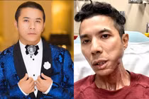 Kasim Hoàng Vũ không còn khả năng ca hát sau phẫu thuật 