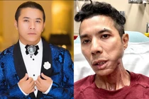 Kasim Hoàng Vũ không còn khả năng ca hát sau phẫu thuật 