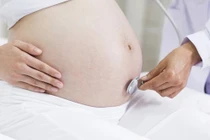 Cứu sống mẹ con sản phụ bị sản giật nguy kịch